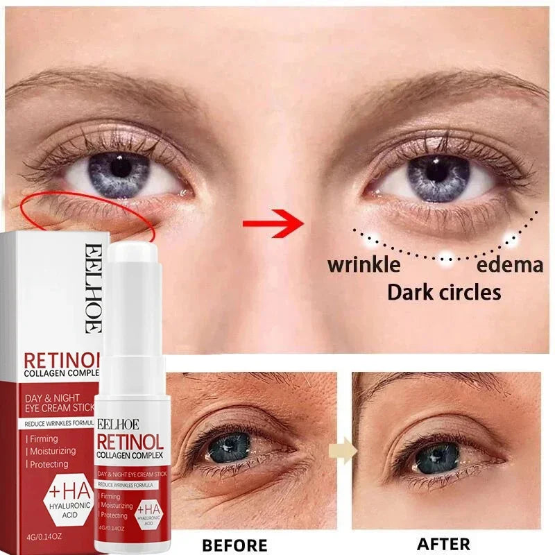 Retinol Wrinkle Removal Facial