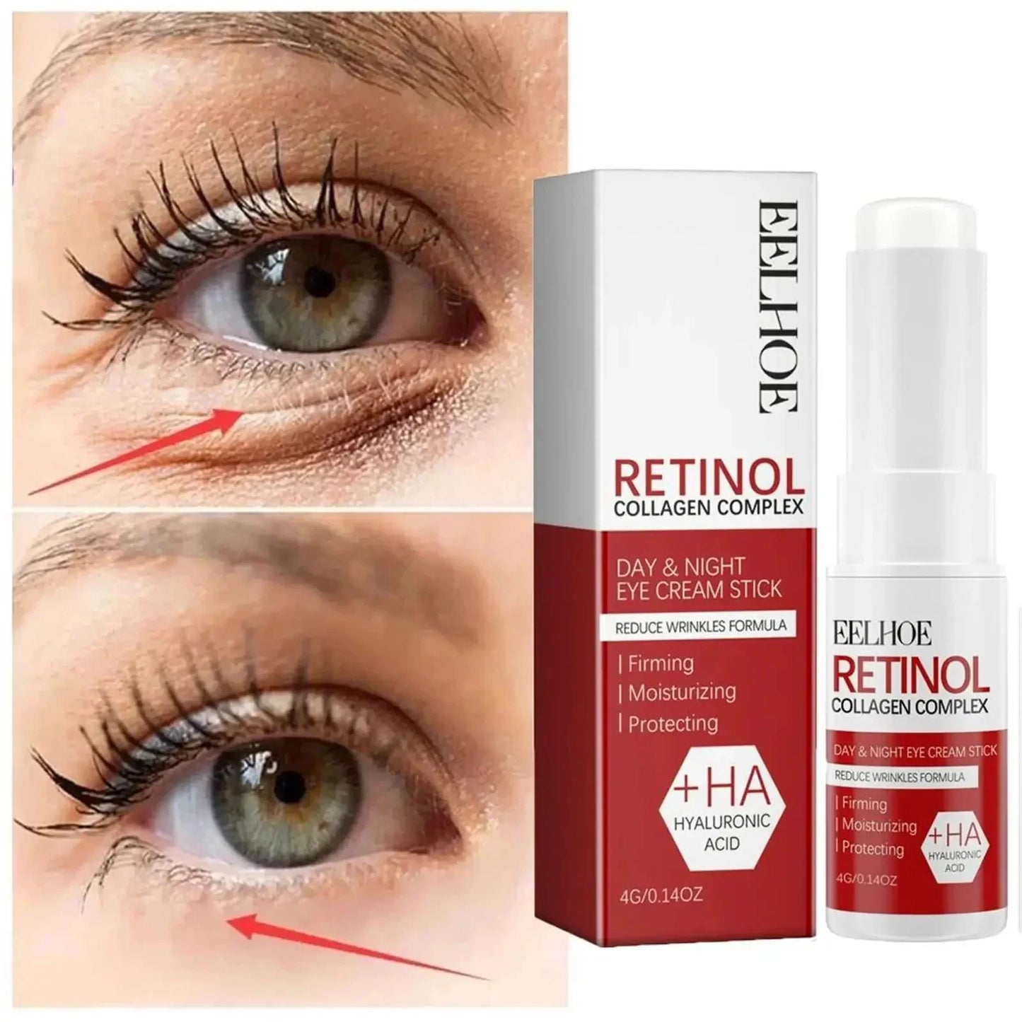 Retinol Wrinkle Removal Facial