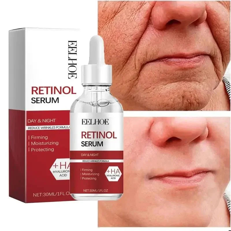 Retinol Wrinkle Removal Facial